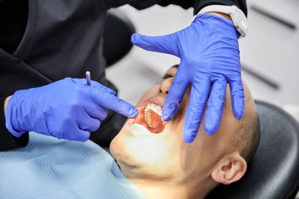 Best Dentist for Dental Trauma  in Troup, TX